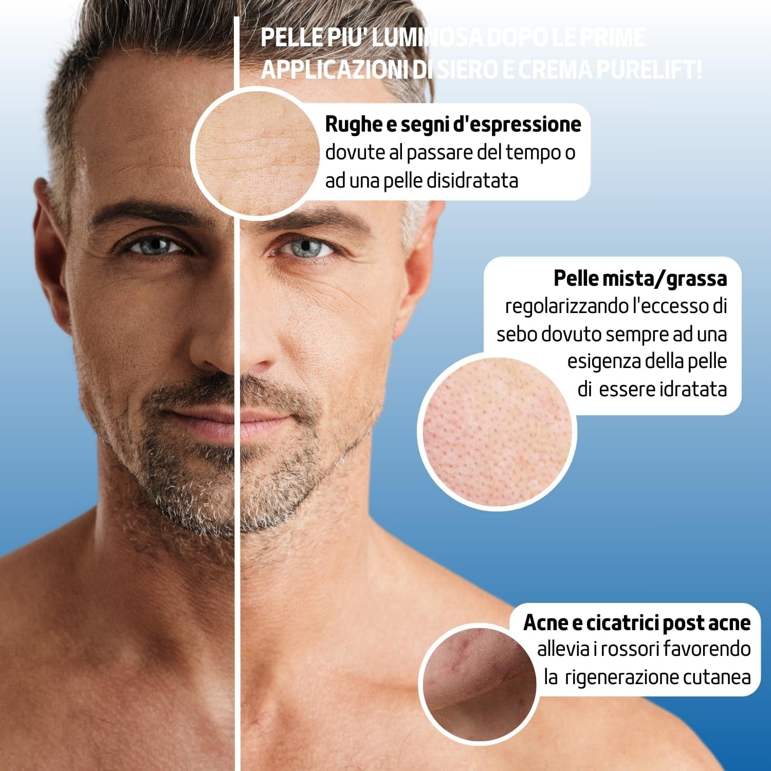 100 Ml | Siero Viso Acido Ialuronico E Vitamina C Con Bava Di Lumaca, Siero anti Imperfezioni Antirughe E Antimacchia, Siero Viso Pelle Grassa Naturale E Made in Italy - FITOATTIVI