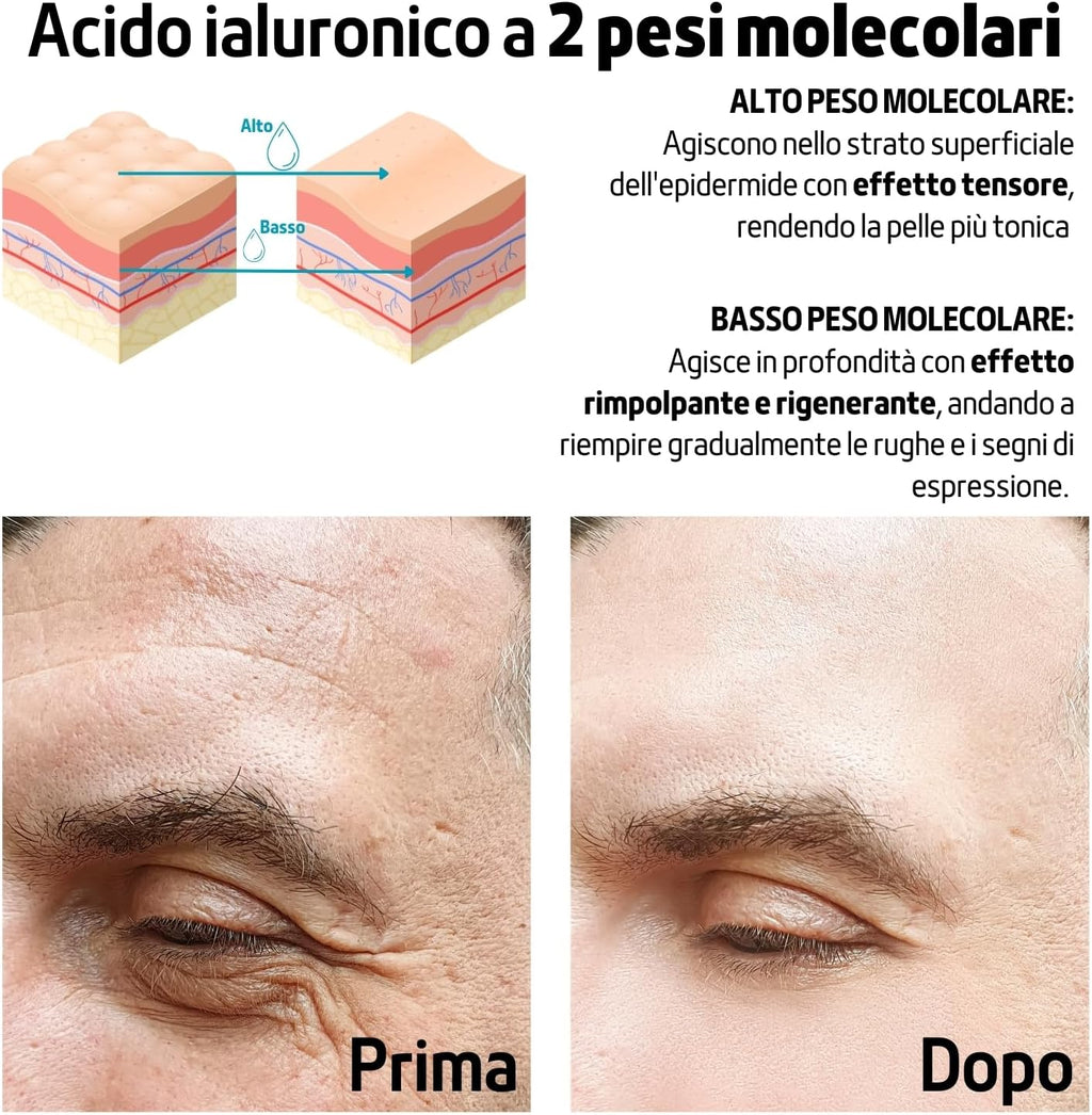 100 Ml | Siero Viso Acido Ialuronico E Vitamina C Con Bava Di Lumaca, Siero anti Imperfezioni Antirughe E Antimacchia, Siero Viso Pelle Grassa Naturale E Made in Italy - FITOATTIVI